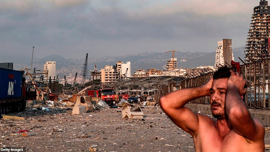 Bác sĩ Noun cho biết thêm, một số bệnh nhân của ông - trẻ em bị ung thư - và các thành viên gia đình của họ cũng bị thương do ảnh hưởng của vụ nổ. Ảnh: Getty.