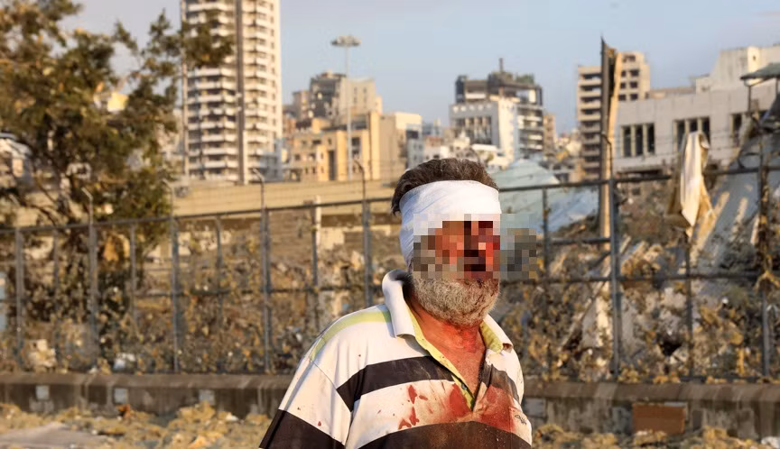 Vu no o Li Bang: Benh vien “vo tran”, thuong vong khong ngung tang-Hinh-5