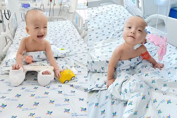 Hai be song Nhi co the ngoi day choi dua sau mot thang mo tach