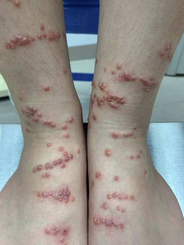 Khi tam bien bi sua dot, tuyet doi khong lam dieu nay-Hinh-2