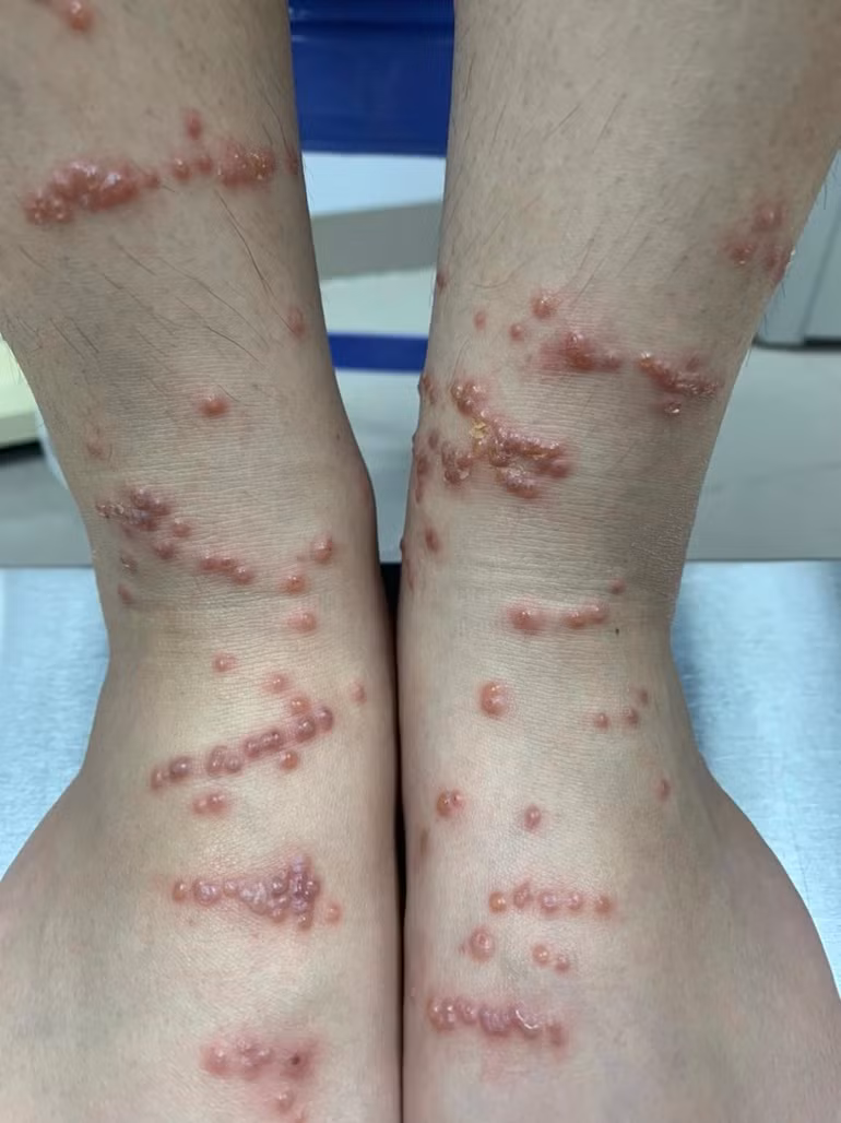 Khi tam bien bi sua dot, tuyet doi khong lam dieu nay-Hinh-2