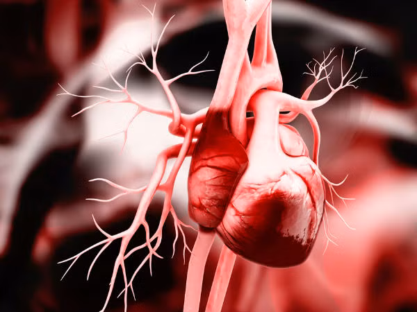 Hội chứng Marfan là một rối loạn di truyền ảnh hưởng đến các mô liên kết được tìm thấy khắp cơ thể. Tim và mạch máu, mắt, hệ xương... thường bị ảnh hưởng bởi bệnh này.