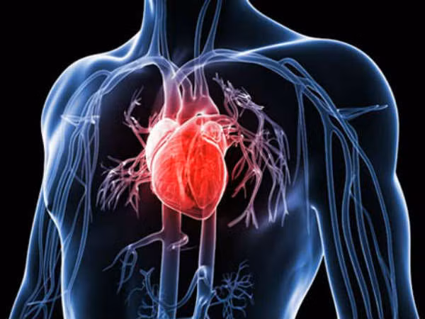 Bệnh mạch vành làm hạn chế lưu lượng máu và oxy đến cơ tim, dẫn đến ngừng tim đột ngột.