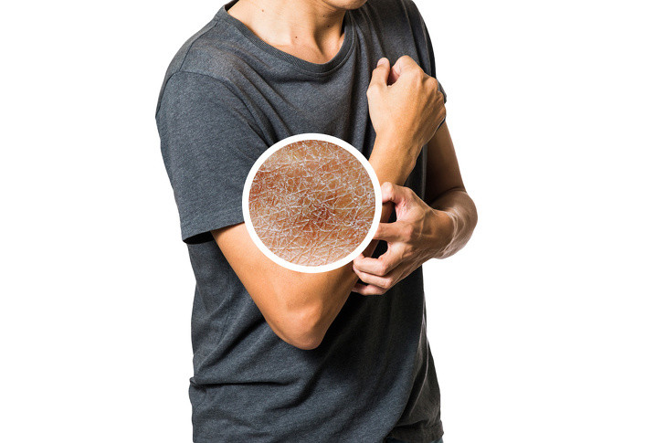 Không dùng kem dưỡng ẩm khiến da khô và lão hóa nhanh. Bạn nên sử dụng kem dưỡng ẩm ngay sau khi tắm vì nó hấp thụ tốt hơn khi da bạn ấm. Ảnh: BS.