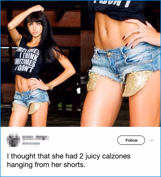 Quần sort hở túi.