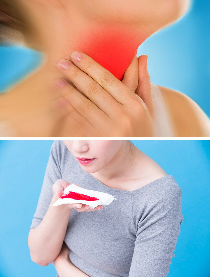 Ho không ngừng: Cơn ho có thể xuất phát từ nhiều vấn đề khác nhau và nó cũng có thể là dấu hiệu của bệnh tim mạch. Ho dai dẳng tạo ra một chất lỏng màu hồng có chứa máu là triệu chứng phổ biến của bệnh suy tim.