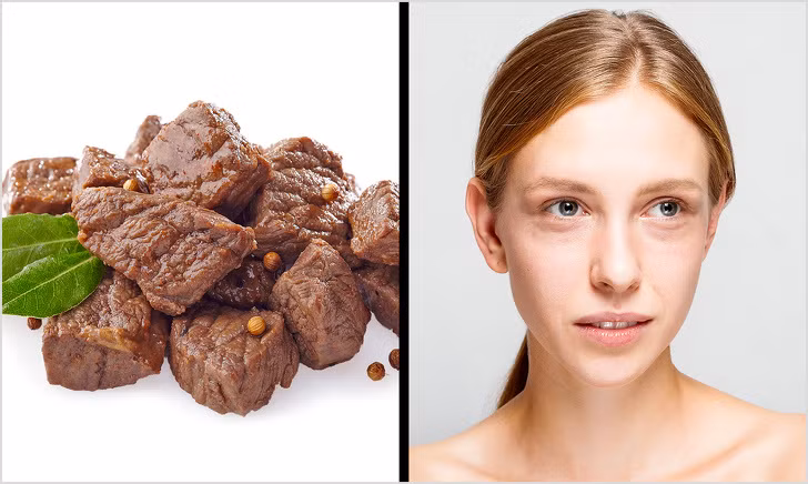 Ăn nhiều protein động vật khiến da xỉn và độ đàn hồi kém: Ăn quá nhiều protein động vật cón thể làm chậm sự trao đổi chất, sản xuất men và hormone, điều này đồng nghĩa với việc tái tạo da cũng chậm theo.