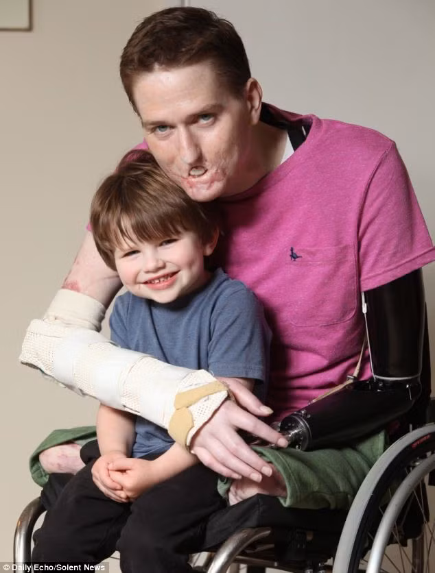 Tinh thần lạc quan của Alex Lewis là thứ mà không phải ai cũng có được.