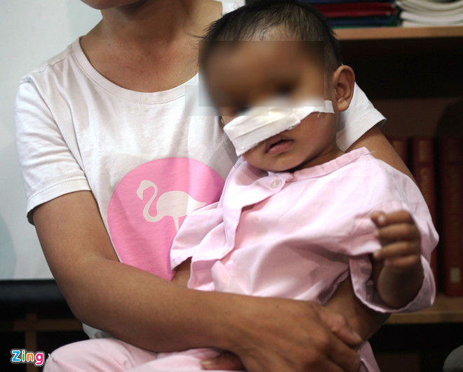 Sau sự việc, gia đình đưa bé vào bệnh viện sơ cứu đồng thời lấy phần thịt bị đứt rời bỏ vào thùng đá bảo quản rồi chuyển bé xuống TP.HCM tiếp tục cấp cứu. Tại Bệnh viện Nhi đồng 1, các bác sĩ đánh giá vết thương, xử lý phần thịt bị đứt rời để phẫu thuật tạo hình đắp lại phần cánh mũi.