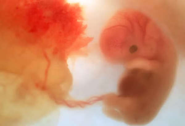 Bước sang tháng thứ 2, kích thước của bé khoảng 1-1,3cm. Mí mắt, mũi và đôi tai của thai nhi đang thành hình.Tay và chân của bé cũng dần dài ra.