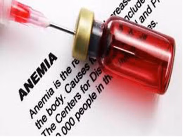 Khi tim bạn không thể bơm máu và ô xy đến các bộ phận khác của cơ thể do bệnh tim thì sẽ gây ra tình trạng thiếu máu.