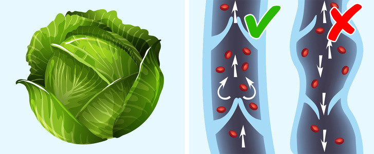 Lá cải bắp cũng có thể làm giảm sưng tĩnh mạch. Cắt lá bắp cải cho vào máy xay sinh tố. Thêm một ít nước để xay thành bột nhão. Bôi lên khu vực bị sưng. Che vùng đó bằng vải cotton và để chúng trong 2 giờ. Rửa sạch bằng nước.