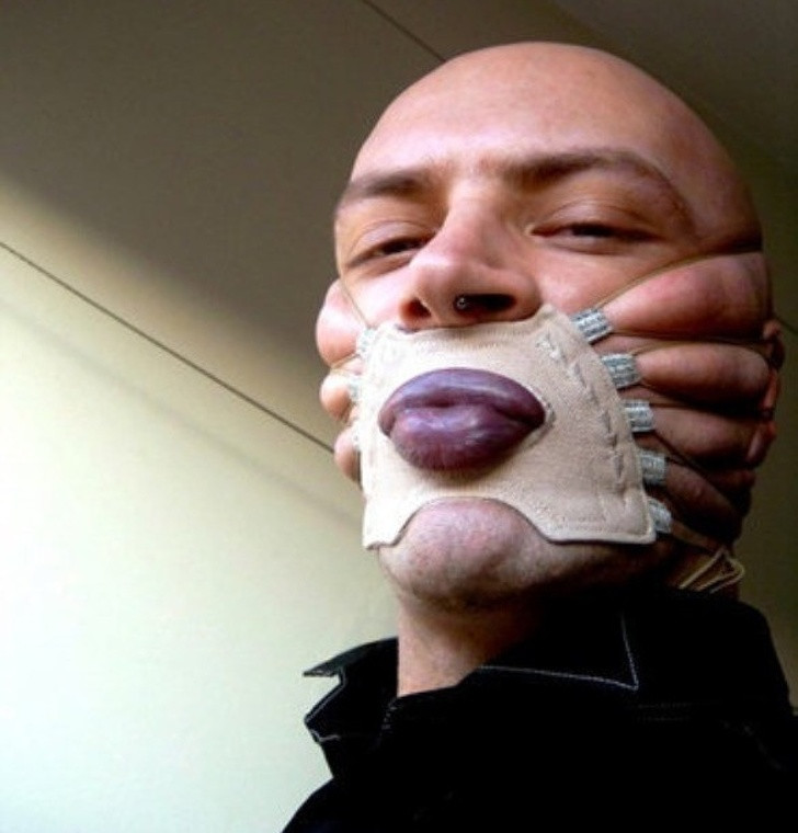 Liệu đây có phải sản phẩm tạo môi cong?