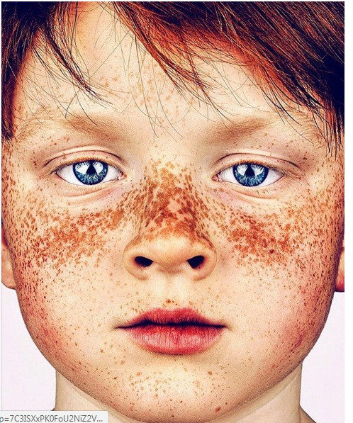 Cậu bé có làn da rám nắng độc đáo.