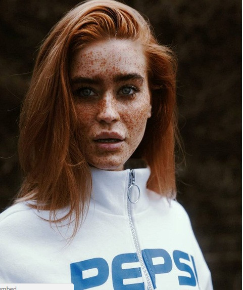 Mặt trời đã biến khuôn mặt của cô ấy trở nên như vậy.