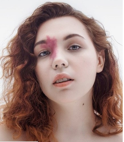 Khiếm khuyết cũng không thể làm khuôn mặt cô ấy kém xinh hơn.