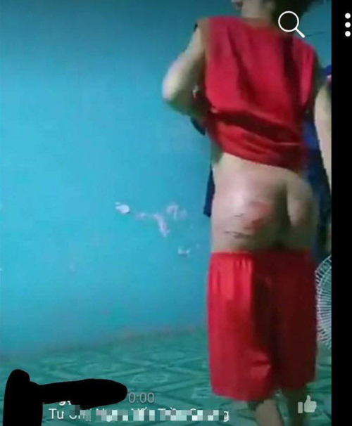 Tiet lo kho tin vu chau be nghi bi “nguoi tinh cua me” sat hai