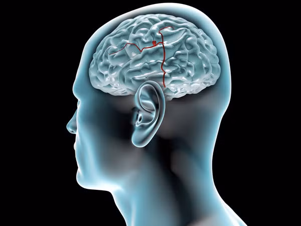 Ăn cá rô phi có thể giúp tăng cường chức năng não vì nó chứa nhiều chất béo omega-3 làm tăng chức năng thần kinh. Thêm vào đó, cá cũng chứa selen bảo vệ não khỏi các bệnh khác nhau như bệnh Alzheimer, Parkinson và động kinh.