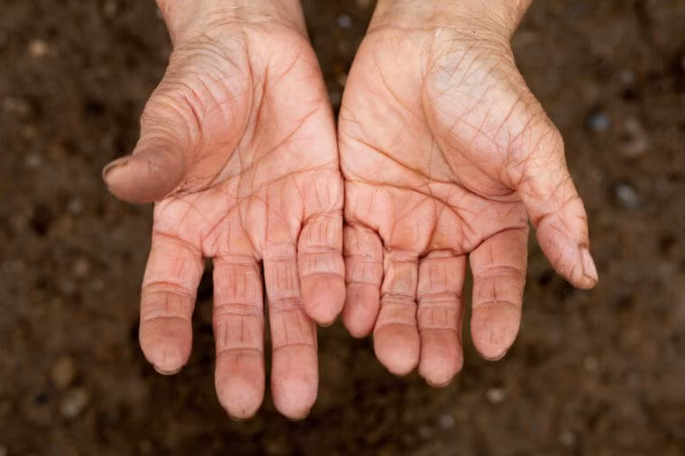 Tay của bạn sẽ là một trong những bộ phận cơ thể lão hóa sớm nhất của cơ thể. Thay đổi nội tiết dẫn đến mất độ đàn hồi của da giảm và bàn tay của bạn có thể nhăn nheo hơn và các mạch máu cũng nổi rõ hơn.