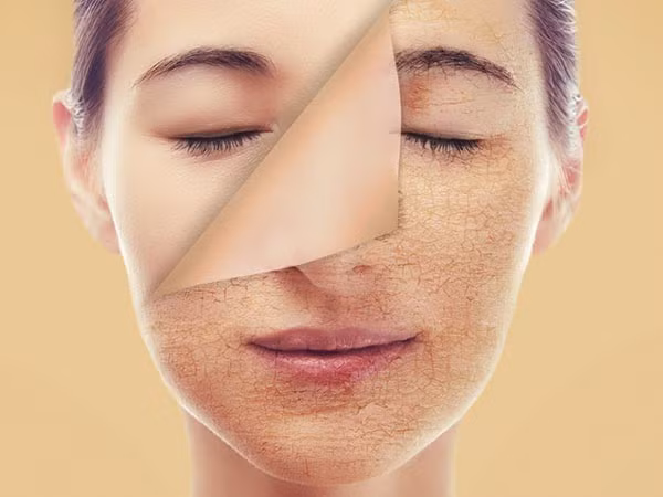 Acid salicyic trong dâu tây có tác dụng như chất tẩy tế bào chết, giúp loại bỏ da chết và nhân mụn trứng cá ra khỏi da.