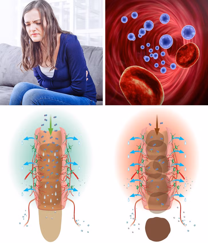 Táo bón: Nếu bạn không đi cầu hàng ngày, các chất độc được hấp thụ trở lại vào máu. Trong trường hợp này, uống nhiều nước và tăng lượng chất xơ có thể giúp giảm tình trạng táo bón.