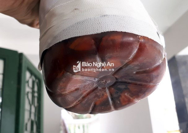 Nạn nhân Moong Văn Mươi thậm chí không thể ngồi dậy sau khi uống một vài chén. Người đàn ông 34 tuổi này đã ngã gục ngay tại chiếu rượu trước khi được chở đi cấp cứu.