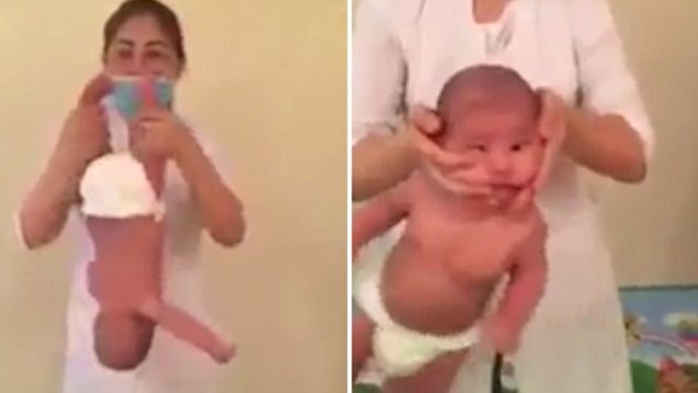 Chuyên gia cảnh báo phương pháp trị liệu này có thể khiến cậu bé có nguy cơ bị trật khớp xương. Ảnh: The Sun.