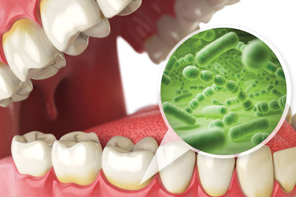 Chống sâu răng: Bột ca cao chứa nhiều hợp chất có chứa đặc tính chống kích thích, kháng khuẩn và miễn dịch góp phần vào sức khỏe răng miệng. Bột ca cao thúc đẩy răng khỏe mạnh bằng cách chống lại vi khuẩn gây sâu răng.