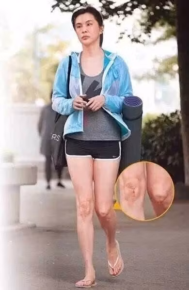 Hình ảnh Vương Tổ Hiền xuống sắc khó tin.