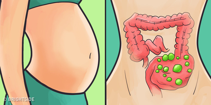 Bổ sung các thực phẩm lên men như sữa chua và kombucha chứa probiotic giúp giữ cho đường ruột chúng ta khỏe mạnh.