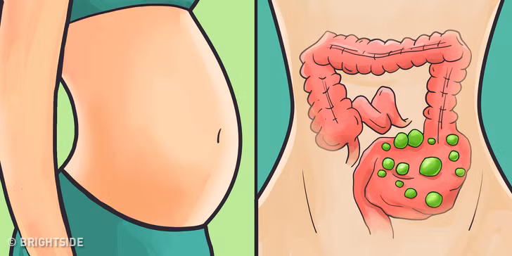 Bổ sung các thực phẩm lên men như sữa chua và kombucha chứa probiotic giúp giữ cho đường ruột chúng ta khỏe mạnh.