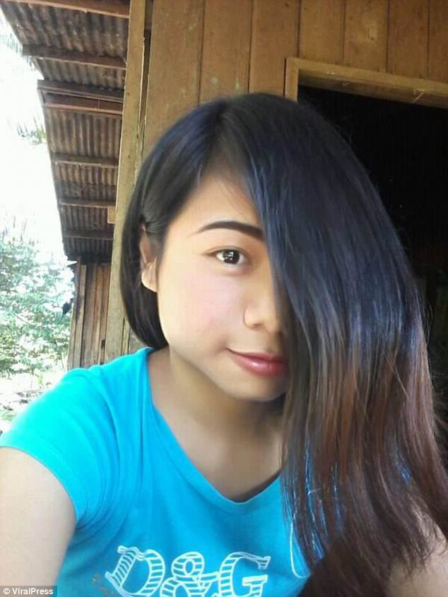 Thiếu nữ xinh đẹp này thường phải xõa tóc để che đi nửa khuôn mặt của mình bởi khối u đáng sợ đã phát triển to bằng quả bóng tennis ở bên mắt trái.