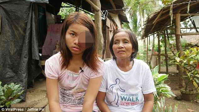 Ước mơ hiện tại của thiếu nữ này là chữa khỏi khối u ở mắt và có bạn trai như bao cô gái đồng chăng lứa khác. Ảnh: ViralPress.