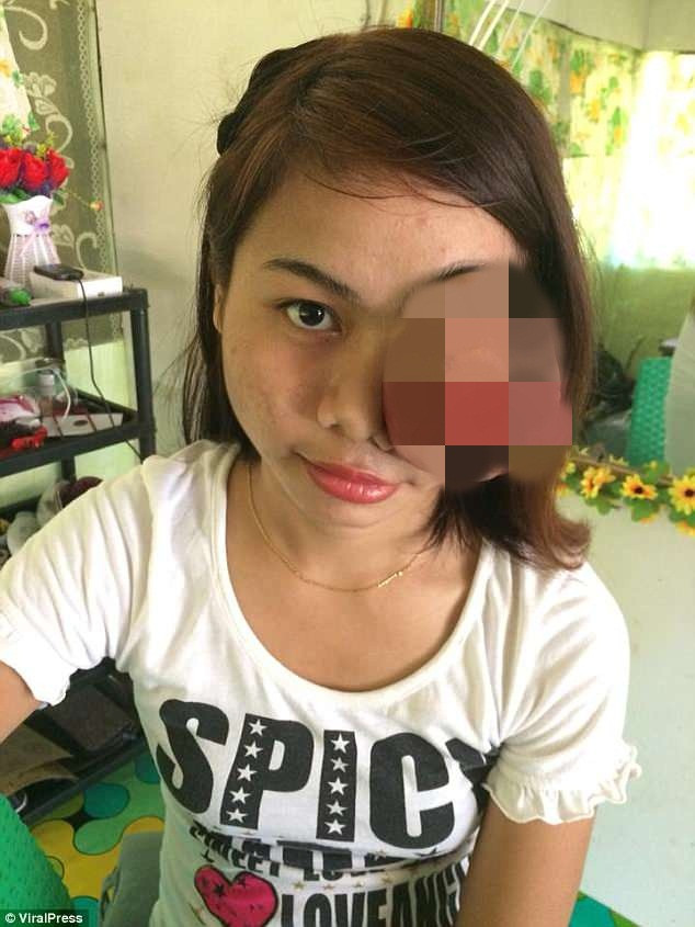 Sophia Savillaga mắc căn bệnh ung thư võng mạc hay còn gọi là u trung biểu mô. Sophia lo lắng khối u có thể trở nên tồi tệ hơn nhưng gia đình không đủ khả năng điều trị.