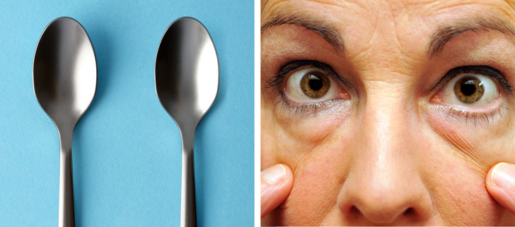 Thìa: Lấy 2 muỗng cà phê kim loại và cho vào tủ lạnh trong 10-15 phút. Sau đó, lấy thìa ra đặt lên mí mắt của bạn trong 30 đến 60 giây. Cái lạnh của kim loại sẽ giúp hồi sinh đôi mắt mệt mỏi và khiến bạn cảm thấy sảng khoái. Ảnh: BS. 