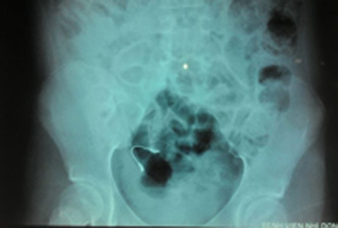 Do khoc do cuoi nhung tai nan nieng rang hy huu