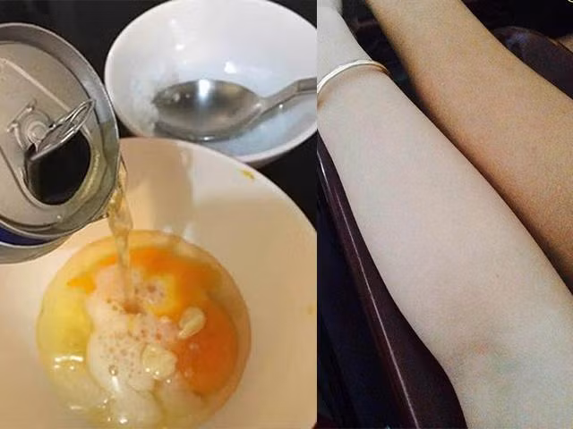 Làm trắng da với bia tiết kiệm mà cực an toàn.