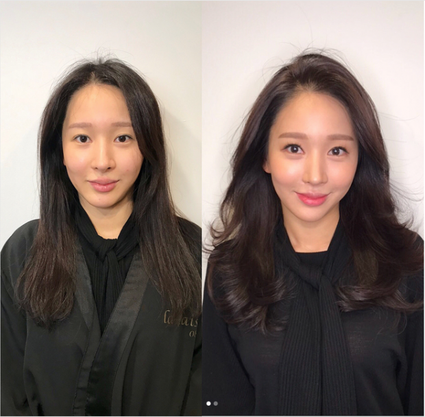 Phẫu thuật thẩm mỹ cũng chỉ giúp bạn lột xác được như thế này mà thôi!