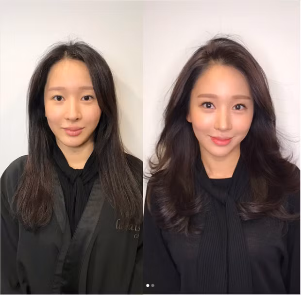 Phẫu thuật thẩm mỹ cũng chỉ giúp bạn lột xác được như thế này mà thôi!