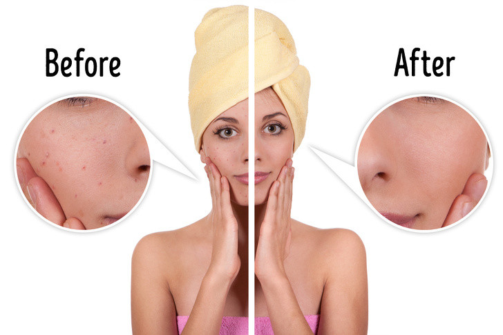 Dưỡng trắng da và giảm nếp nhăn: Lấy một củ khoai tây nghiền, thêm 1 muỗng canh mật ong và 2 muỗng canh dầu ô liu trộn đều. Thoa hỗn hợp lên da trong 10 phút và sau đó rửa lại bằng nước mát.