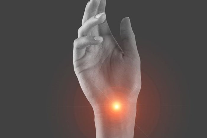 Hội chứng ống cổ tay: Một trong những nguyên nhân phổ biến nhất của tê tay là hội chứng ống cổ tay - một tình trạng trong đó dây thần kinh chạy xuống cẳng tay và tay bạn bị chèn ép ở cổ tay gây tê. Tình trạng này khá phổ biến với những người làm việc nhiều trên máy tính.