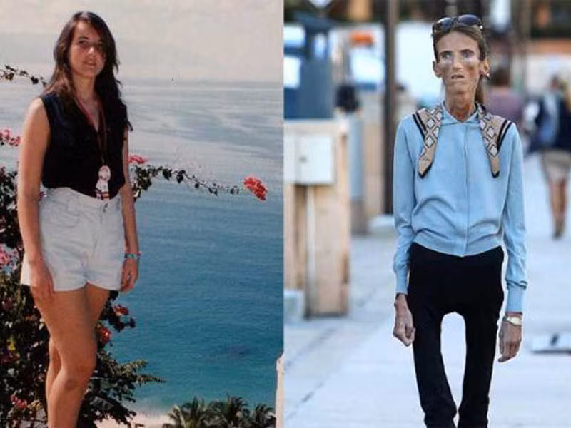 Valeria Levitin đạt danh hiệu người phụ nữ gầy nhất thế giới. Dù sở hữu chiều cao 1m73 nhưng Valeria Levitin chỉ nặng đúng 25kg.