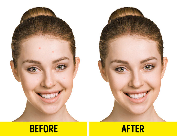 Giúp cải thiện làn da: Nhờ khả năng phục hồi màng tế bào, axit béo omega-3 cũng giúp sửa chữa các tế bào da bị tổn thương từ bên trong. Hiệu quả chống viêm mạnh giúp làm giảm mẩn đỏ và kích ứng và góp phần rất lớn vào vẻ đẹp làn da của bạn.