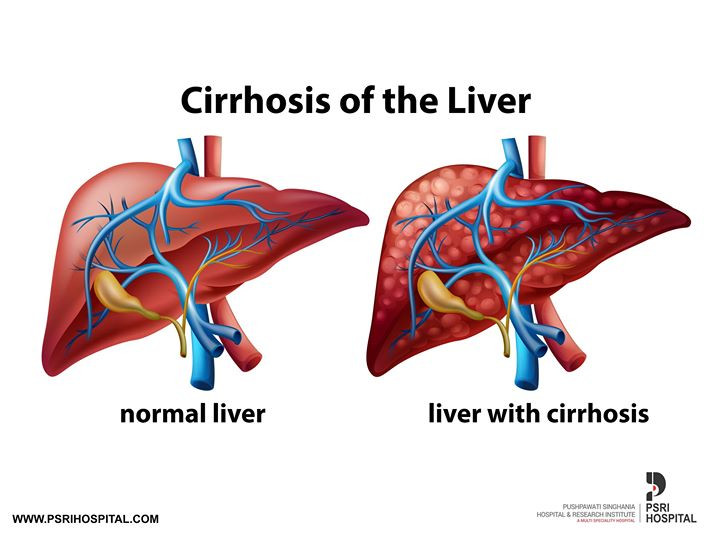 7 xet nghiem phong benh nguy hiem, nguoi lon nao cung nen lam-Hinh-5