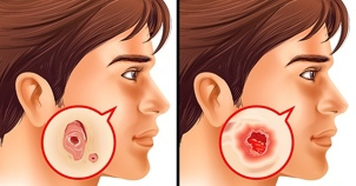 7 xet nghiem phong benh nguy hiem, nguoi lon nao cung nen lam