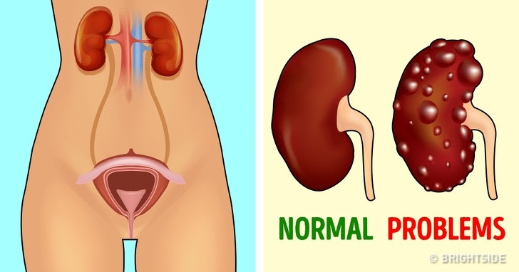 7 xet nghiem phong benh nguy hiem, nguoi lon nao cung nen lam-Hinh-8