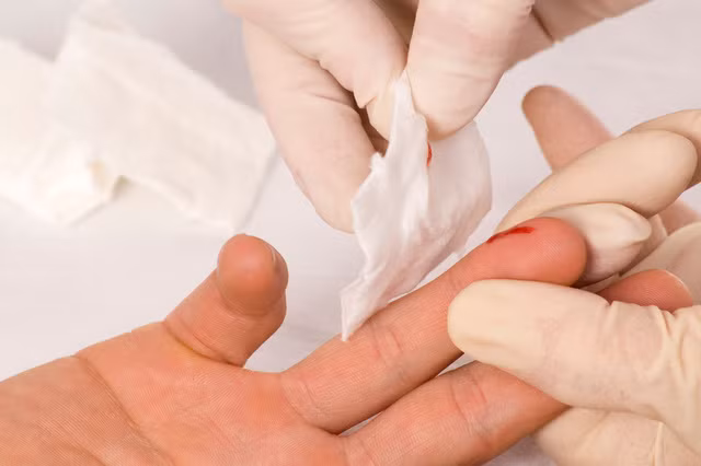 Ngay khi phat hien phoi nhiem HIV, can phai lam gi?