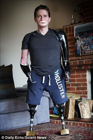 Alex Lewis đã phải học lại từ đầu những hoạt động giản đơn nhất như đi lại, sử dụng hai tay trong công việc hàng ngày.