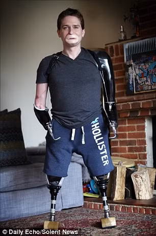 Alex Lewis đã phải học lại từ đầu những hoạt động giản đơn nhất như đi lại, sử dụng hai tay trong công việc hàng ngày.