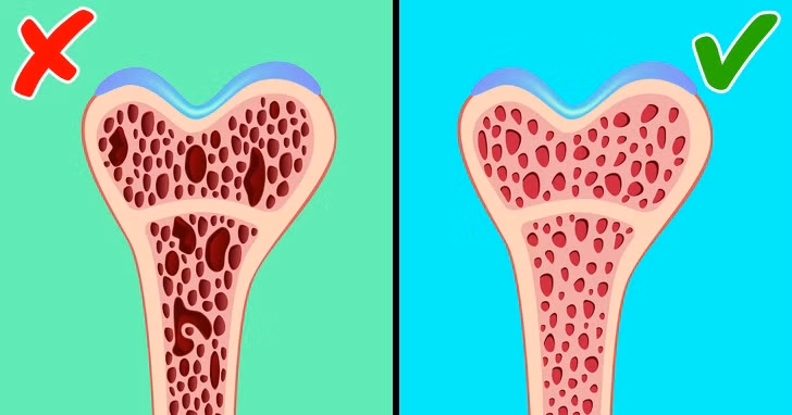 Hạn chế lượng muối: Các nhà khoa học Nhật Bản cho rằng lượng natri dư thừa ảnh hưởng xấu tới sức khỏe của xương gặp nguy hiểm. Do vậy, bạn nên hạn chế ăn mặn. Ảnh: BS.